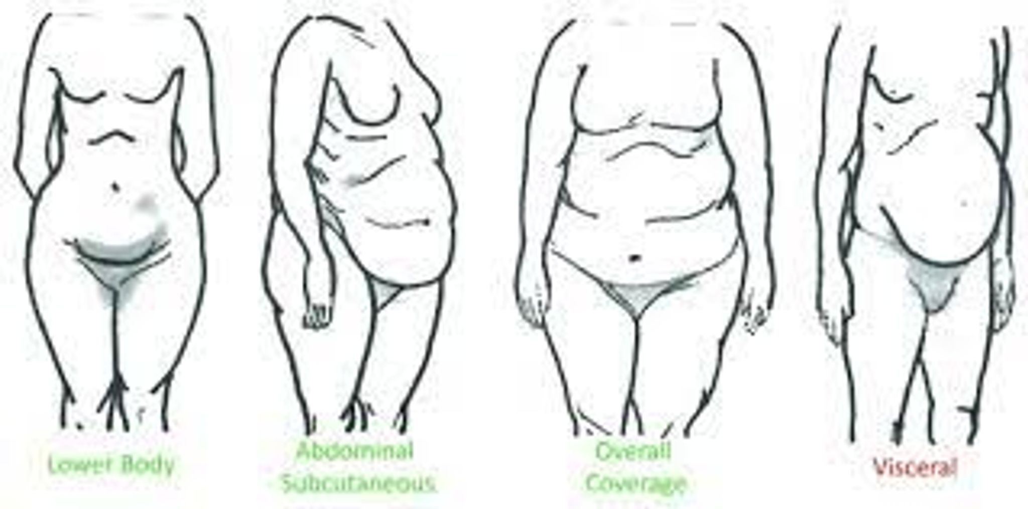 fat  distribution that affect big thighs
